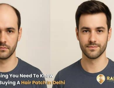 Everything You Need To Know Before Buying A Hair Patch In Delhi