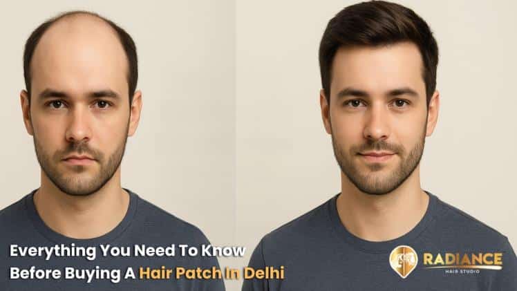 Everything You Need To Know Before Buying A Hair Patch In Delhi